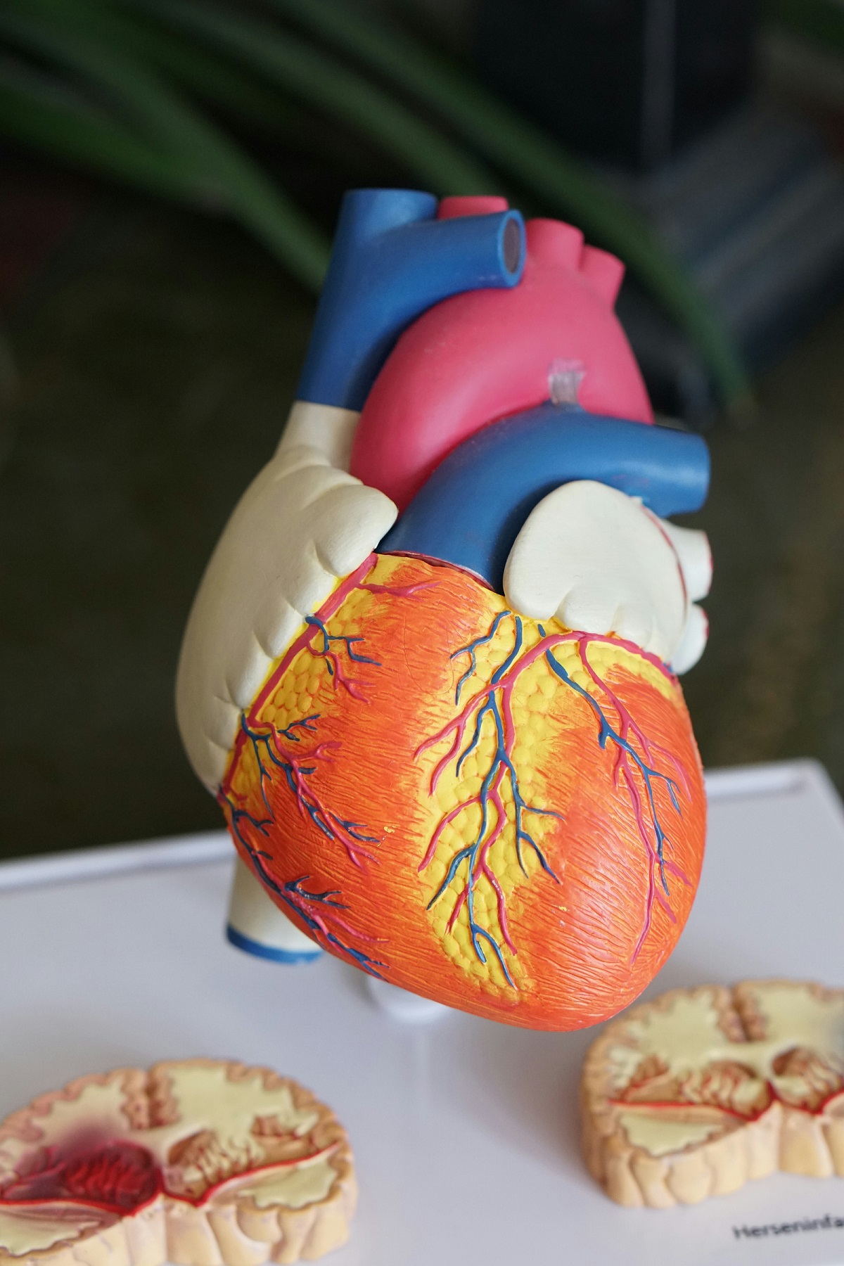 Model of the human heart, representing cardiology care at Careplace Hospital, Abeokuta