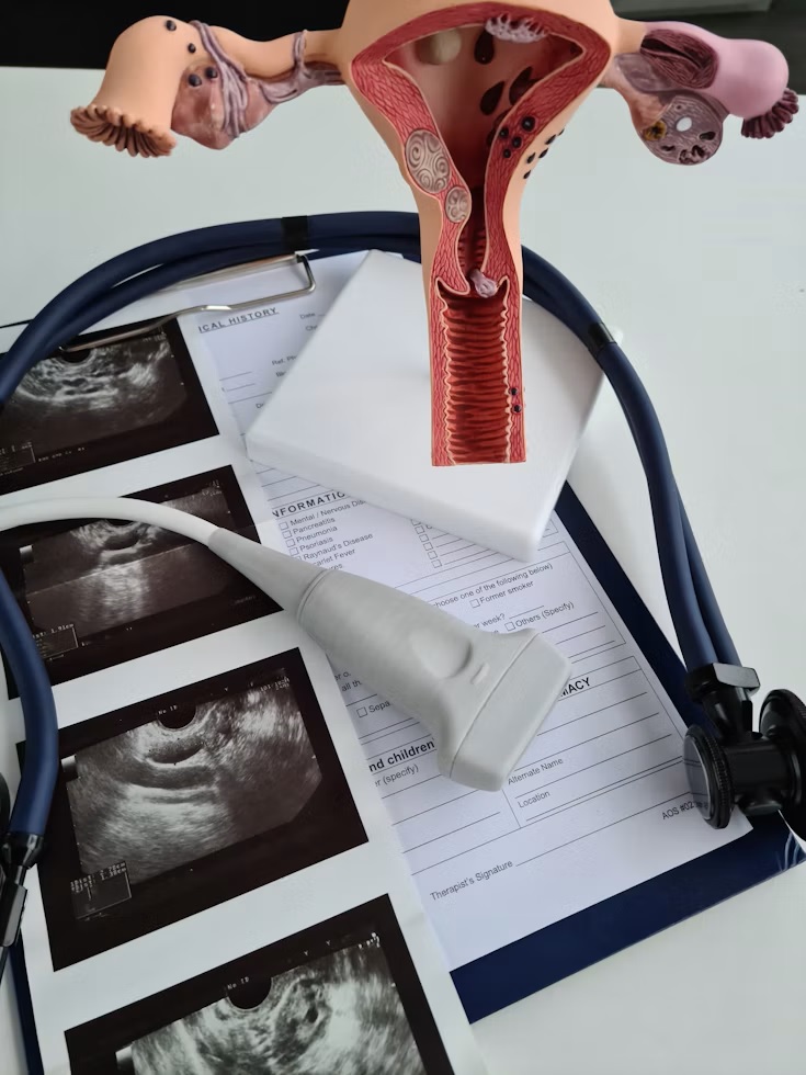 Illustration of the female reproductive system, showing the womb, ovaries and cervix