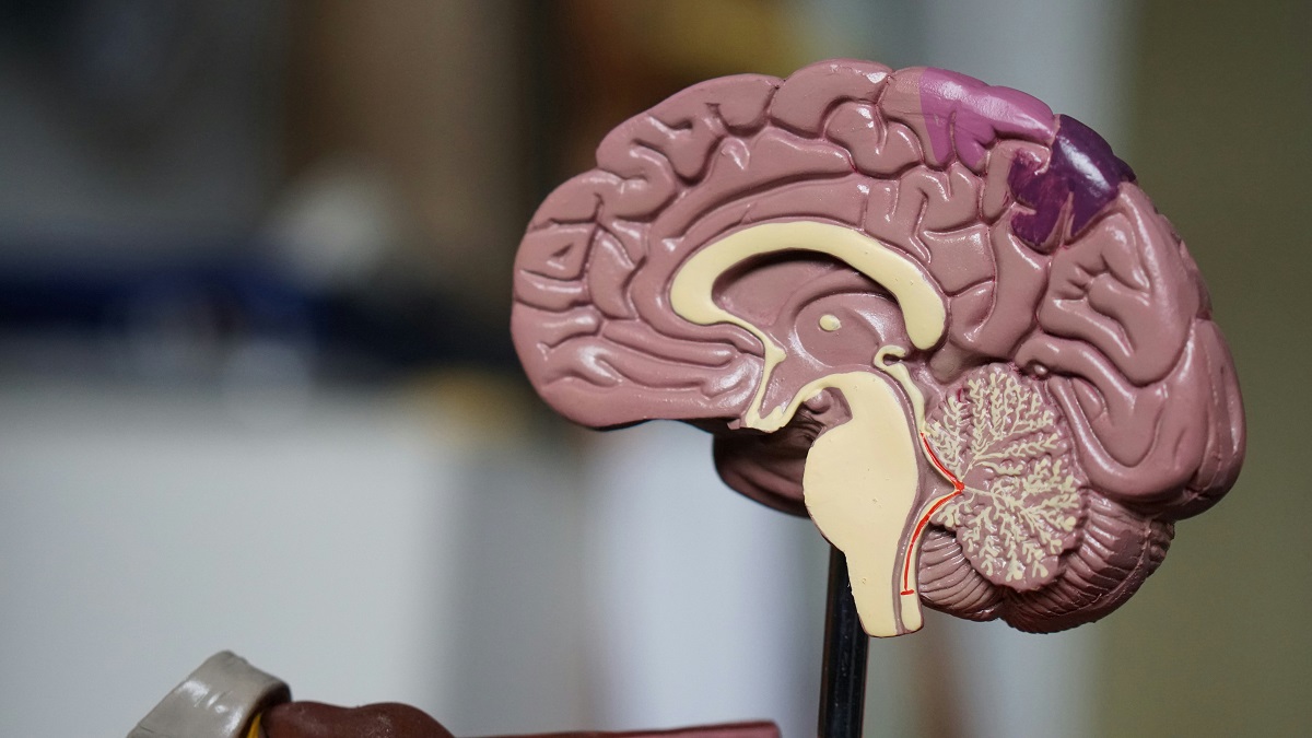Model of the human brain, representing neurology care at Careplace Hospital, Abeokuta